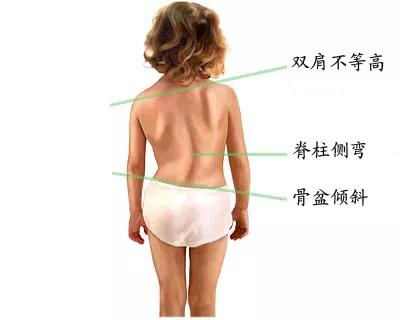 发现自己低智商怎么办,发现自己高低肩怎么办