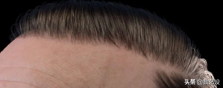 脱发过程3d动画,脱发有救了