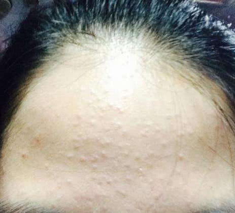 实战经验，必须分享~将闭口扼杀在摇篮中