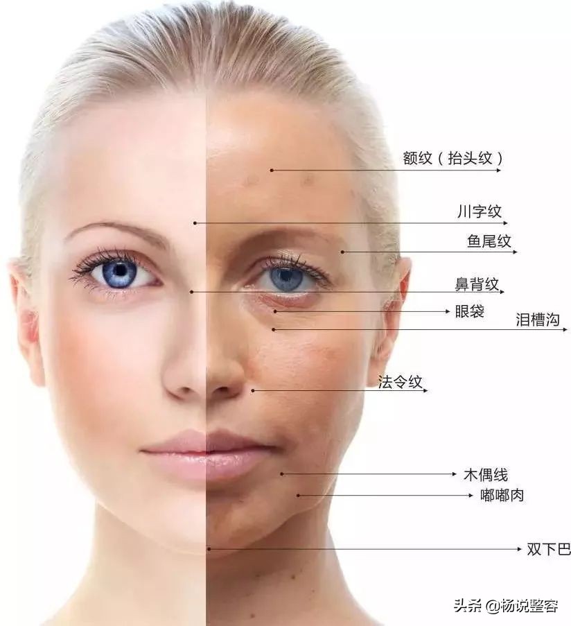 脸上的法令纹越来越深是什么原因,法令纹太明显怎么改善小技巧
