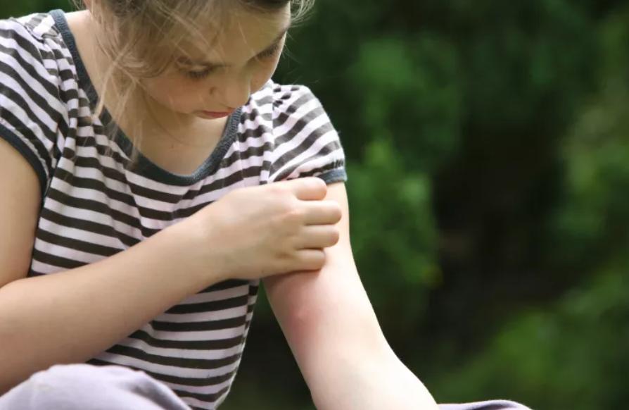 高温多雨，人蚊大战又开始了！没想到这3块钱一瓶的药挺管用
