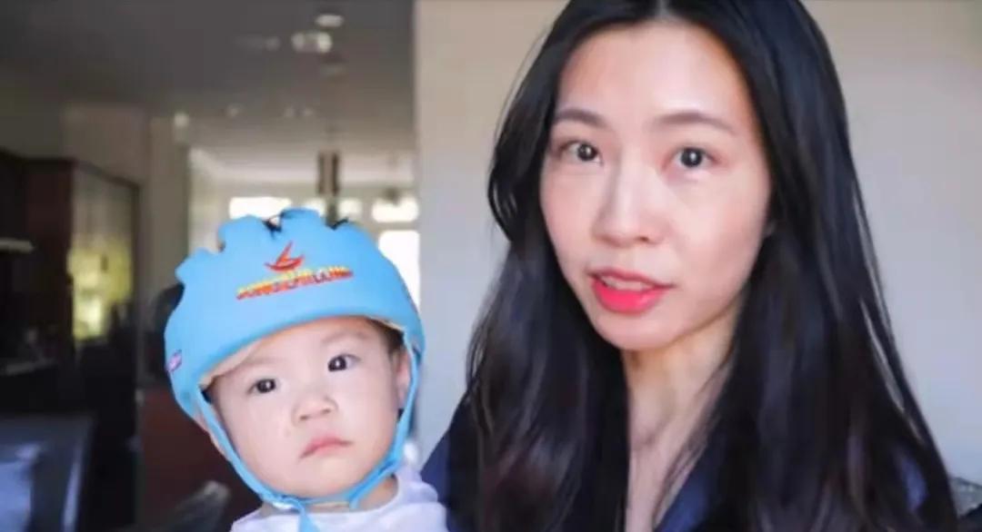 婴儿戴头盔矫正头型变畸形,婴儿戴摩托头盔