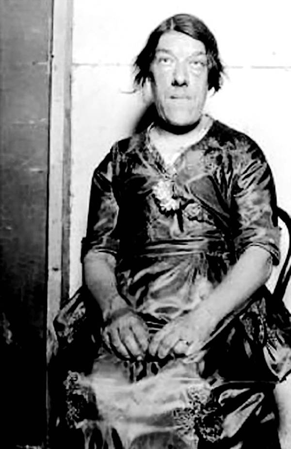 身高不足1米4，拒绝20个求婚者，死后被制成标本展览的传奇女子