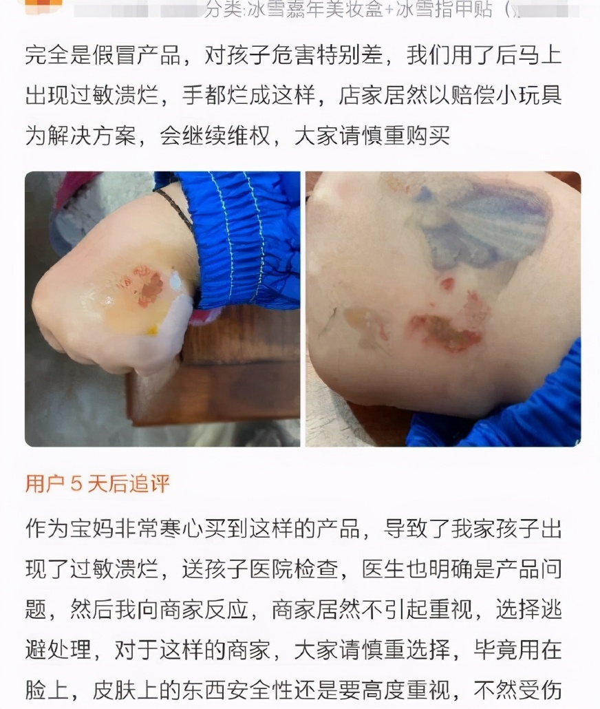 儿童化妆铅中毒,铅中毒皮肤溃烂