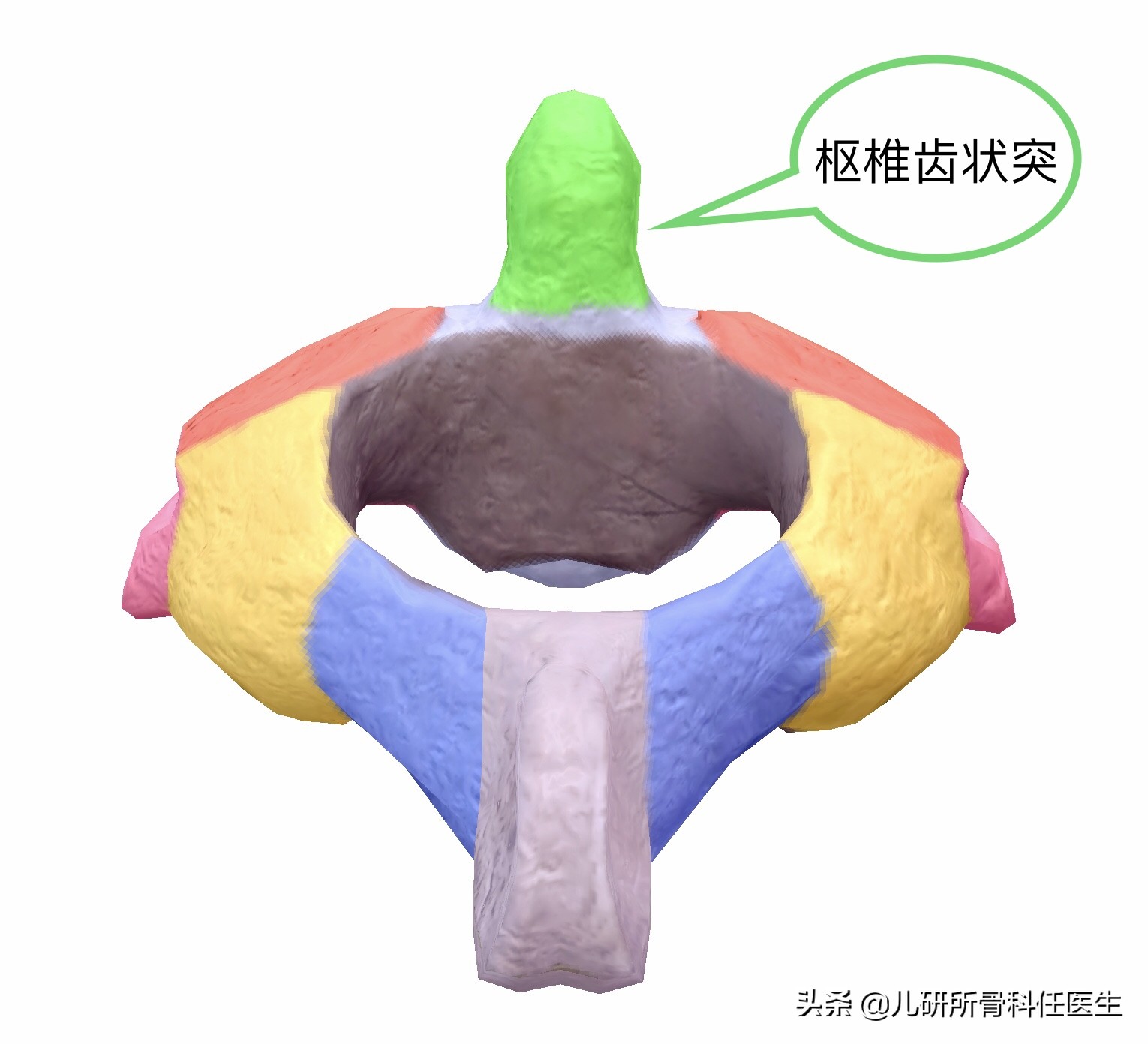 宝宝脖子突然歪了怎么办,小孩脖子落枕了头一直歪着怎么办