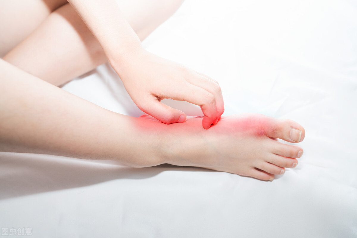 脚气是什么原因造成的怎么治,脚气是什么引起的怎么解决