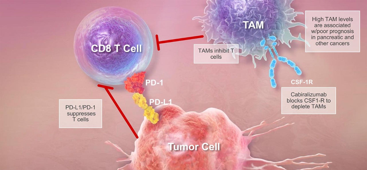 opdivo抗癌药对胰腺癌有用吗,opdivo胰腺癌