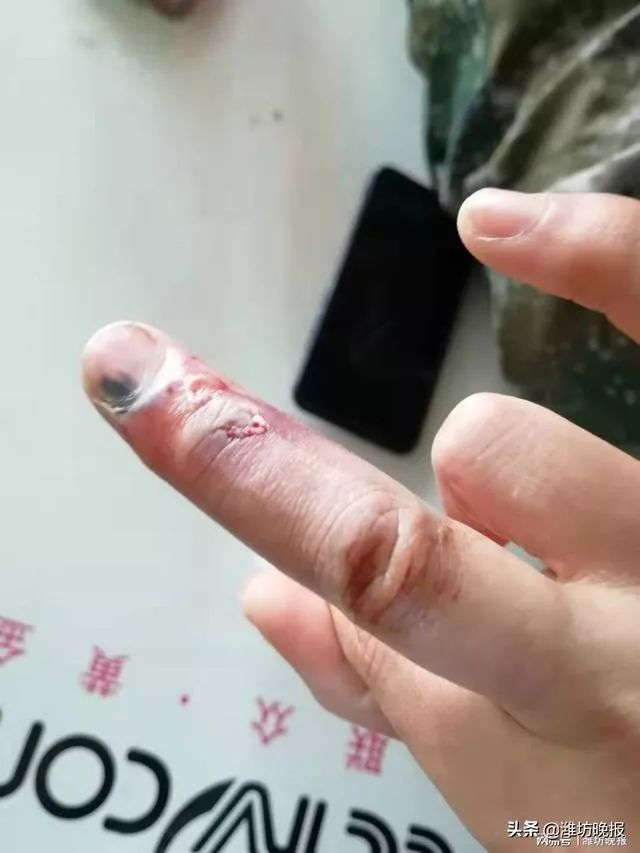 疫情我们能熬过去吗 (疫情期间你熬住了吗)