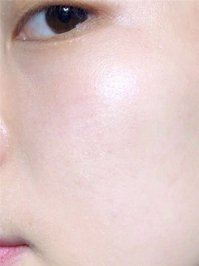 眼部有细纹用什么眼霜可以淡化,眼部有细纹怎么办