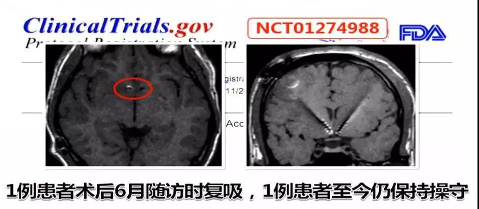 高国栋现在在哪坐诊,高国栋谈戒毒视频