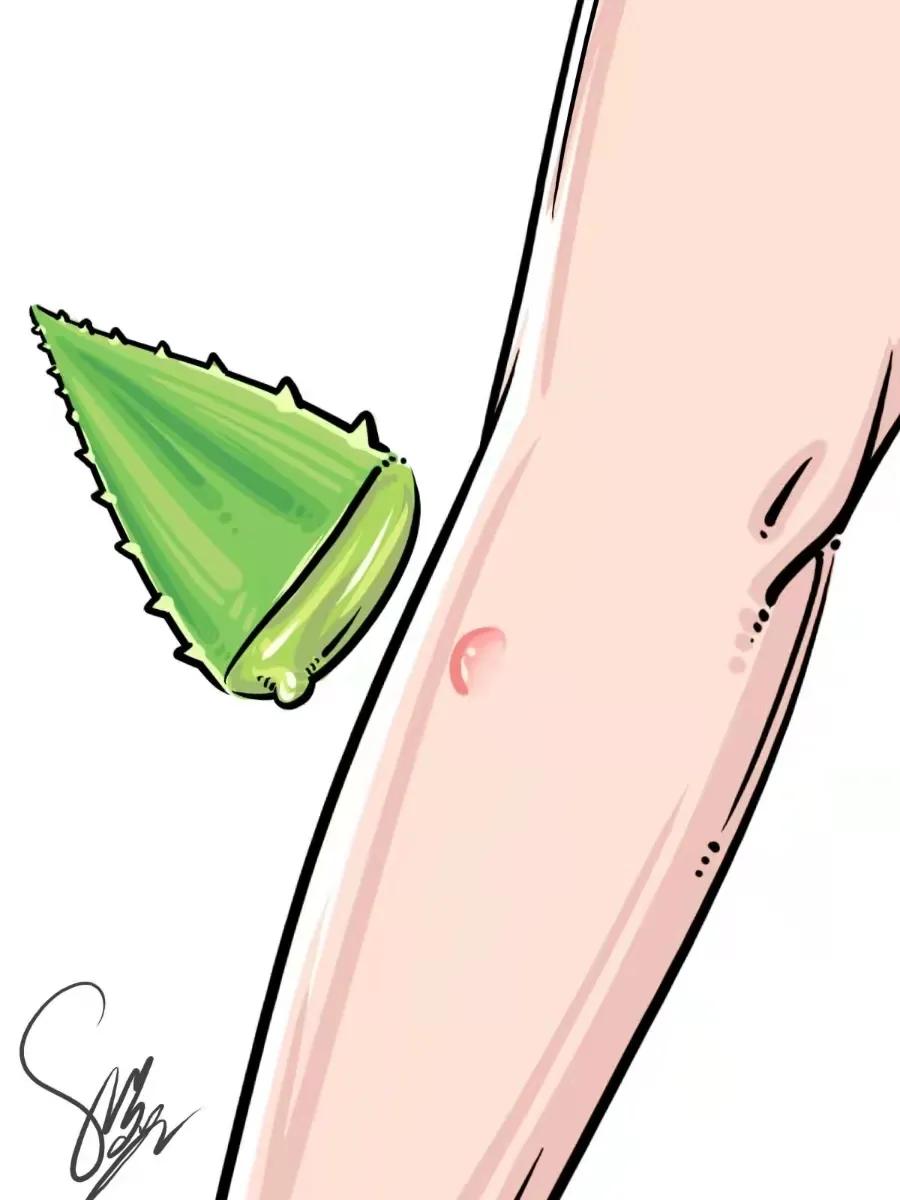 家中的绿植哪些会引起皮肤过敏,家里养的绿植碰了身上痒什么原因