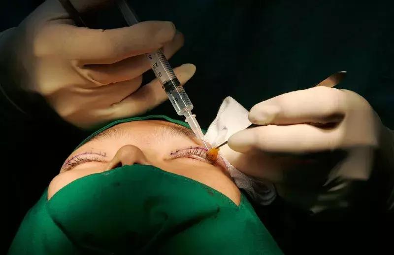 为什么东亚人是浅眼窝,东亚人为什么喜欢皮肤白