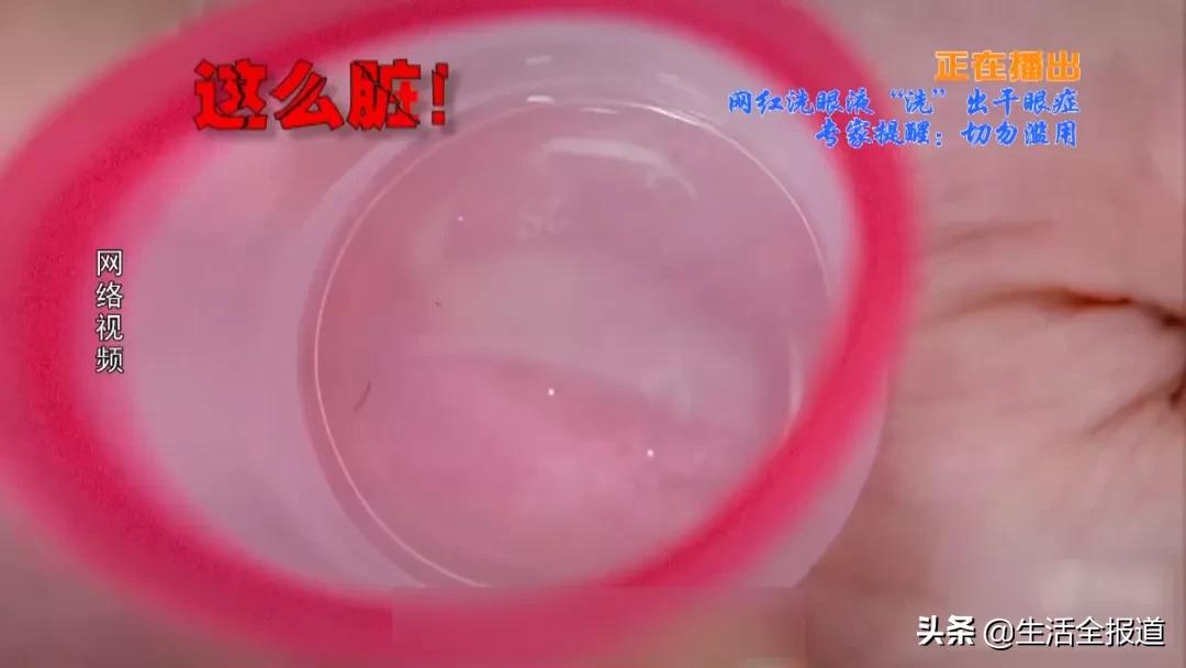 女子爱用洗眼液患上干眼症,网红洗眼液真能明眸健目吗