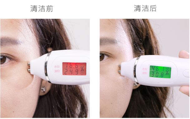 脸油痘痘多黑头用什么简单洗干净,清理黑头痘痘的最简单方法