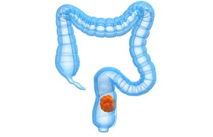 老人长期便秘的危害,老年女人长期便秘的危害