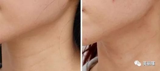 兰蔻粉水屈臣氏,屈臣氏38元兰蔻粉水