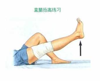 脚踝打了石膏后注意事项,脚踝打石膏一个月正常吗