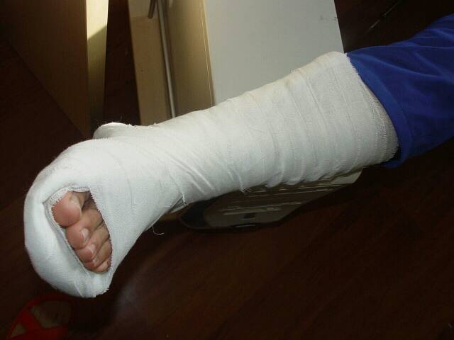 运动中常见损伤的防护和康复,运动损伤需要哪些设备