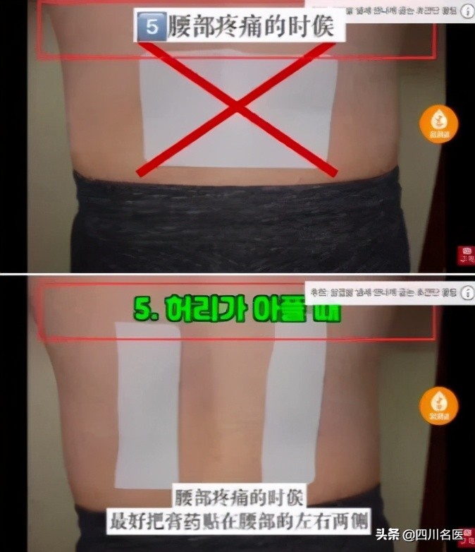 哪儿疼贴哪儿,膏药是不是哪儿疼贴哪儿