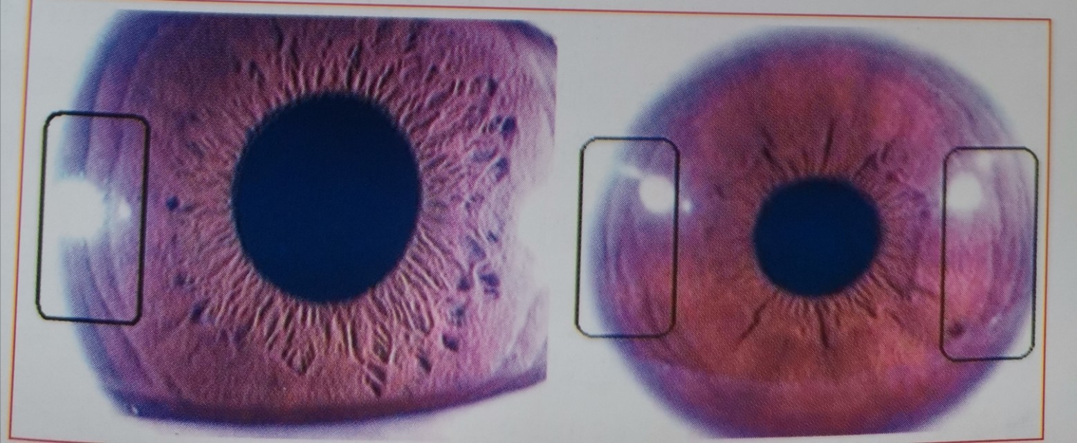 猫得了抑郁症，如何治疗？