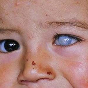 喜好咖啡的朋友注意！头一次听说“咖啡毁眼”？这是真的吗？