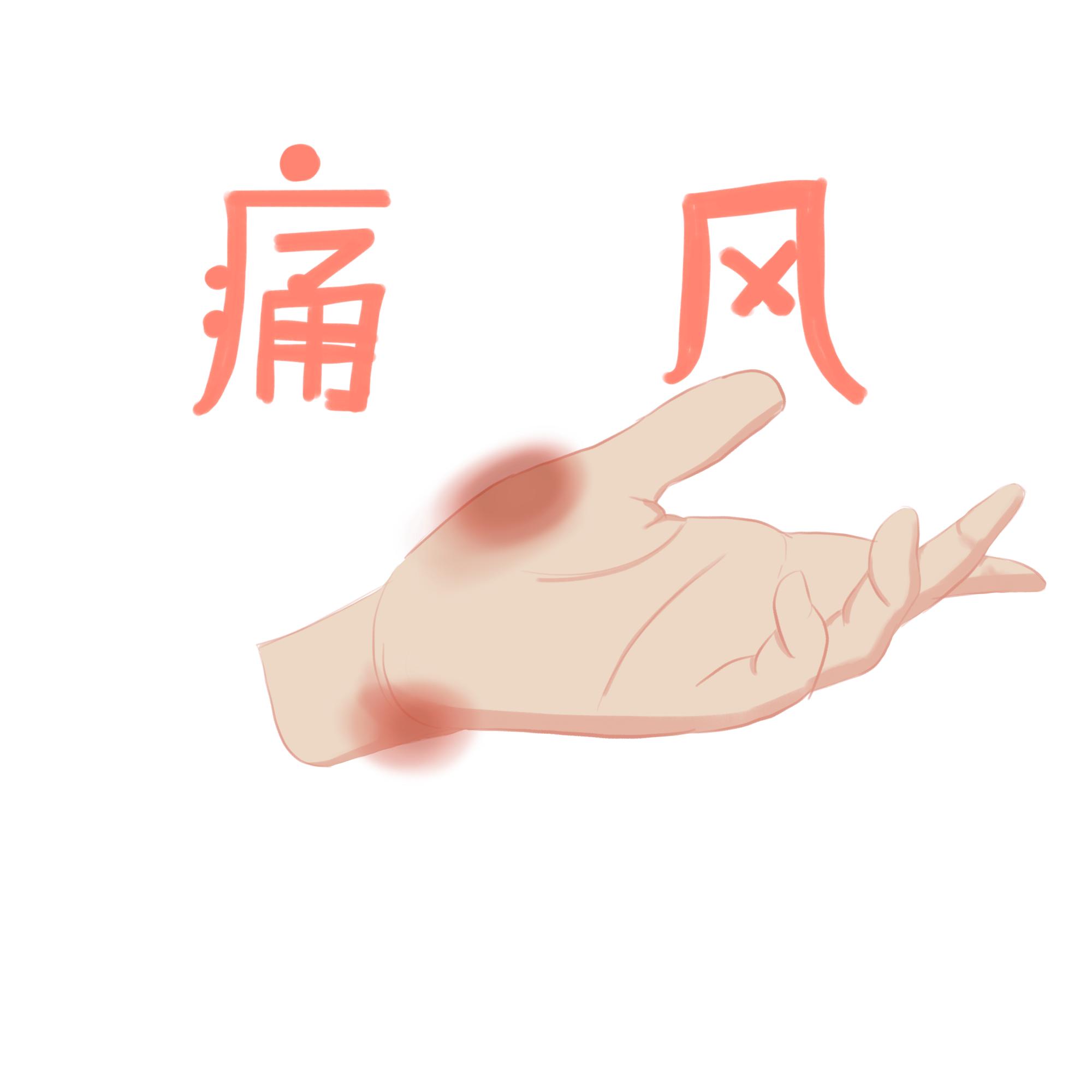 只尿酸高不痛风吃什么药降尿酸,尿酸高降尿酸过程痛风发作