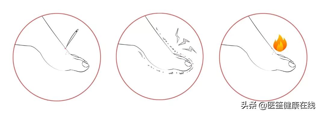 走路时脚的外面会一阵一阵的疼,走路时膝盖处突然刺痛是怎么回事