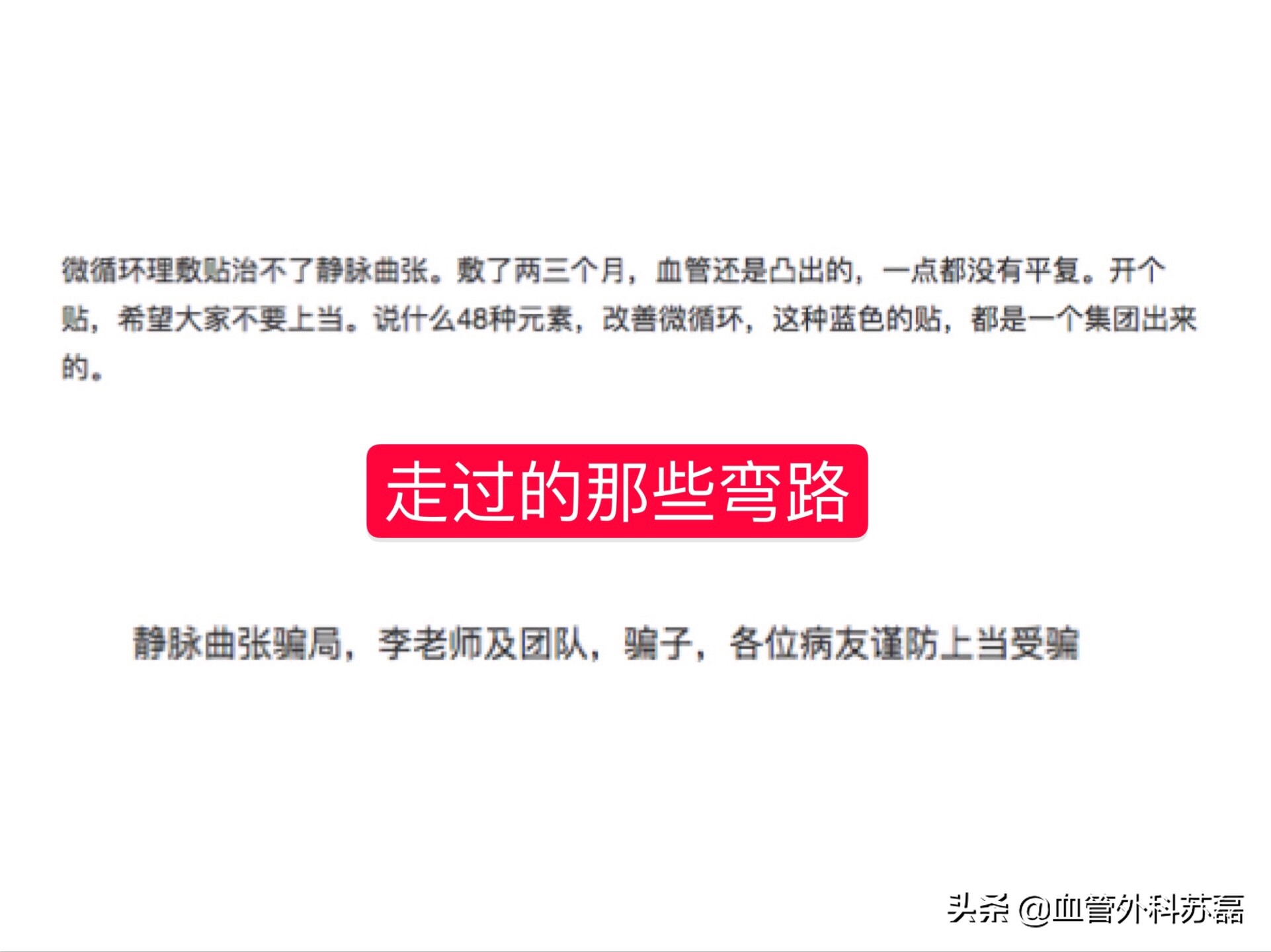 用于治疗下肢静脉曲张的十种药物,网上说中药治疗静脉曲张是否可信