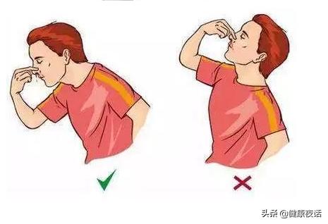 孩子流鼻血怎么办最有效的方法,孩子流鼻血怎么办最有效方法