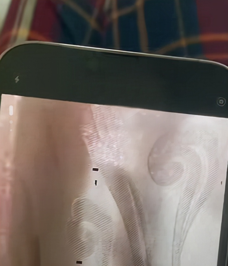 iphone13照片黑斑,iphone13照片马赛克问题解决了吗