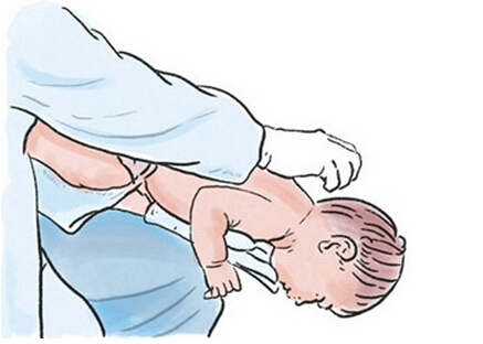 婴儿误食异物噎住,宝宝误吞异物怎么安慰