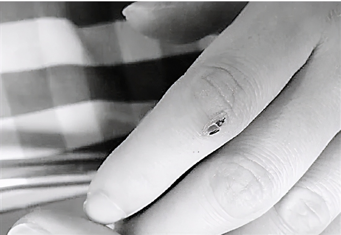 0.08毫克能让人致死，知道我国最毒的蛇有多毒吗？咬后几乎没痛感