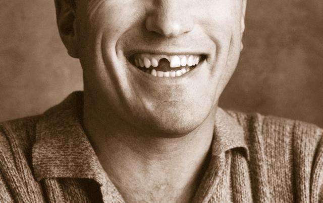 种植牙邻牙歪斜正畸矫正需要多久,种植门牙治疗过程中要一直缺牙吗