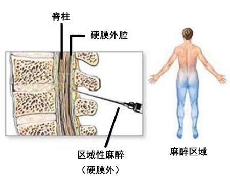 剖腹产让人感动的话,剖腹产出来感人时刻