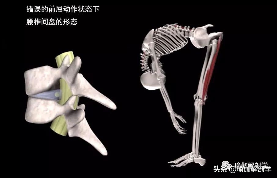 腰椎间盘突出适合练瑜伽哪些动作,腰椎间盘突出做什么瑜伽可以恢复