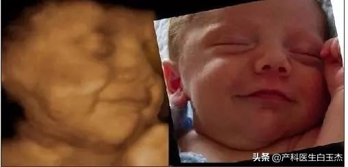 做四维彩超能看到胎儿图片吗,四维彩超图片就是胎儿的样子吗
