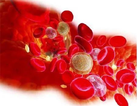 怀疑肺结核必须要做气管镜检查吗,痰里找到结核杆菌就说明肺结核吗