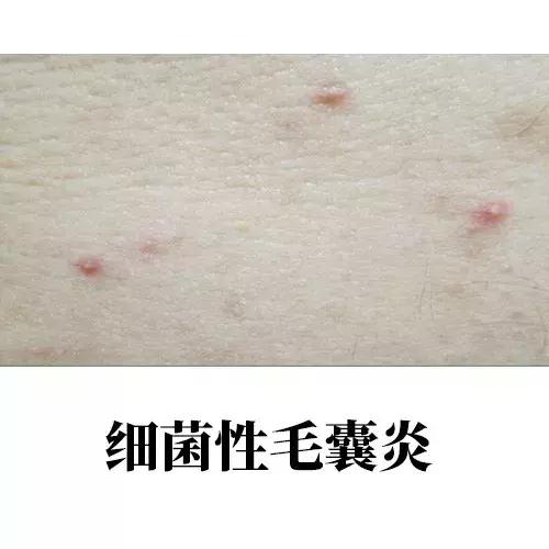 如何拥有美背,拥有美背的人适合学什么舞