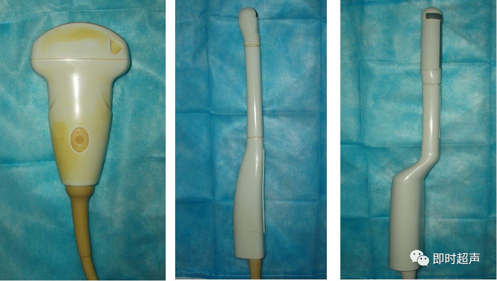 膀胱超声图解大全,膀胱超声解剖及常见病变超声表现