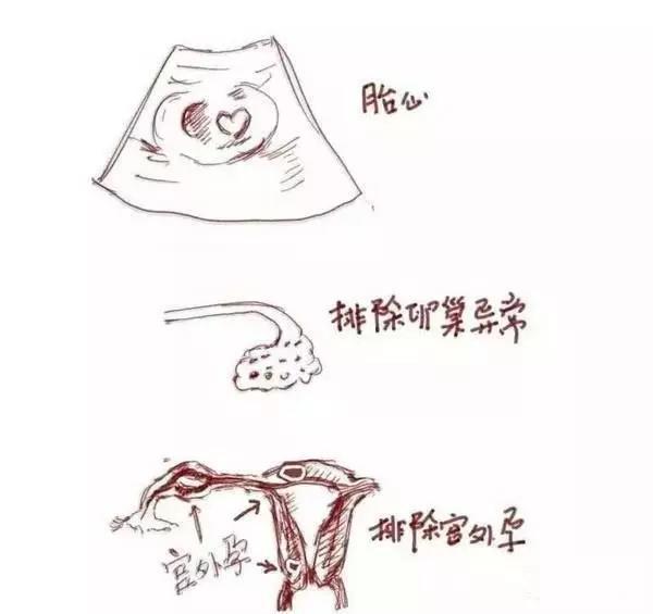 妇产科教你如何看b超,阴超检查酸爽吗