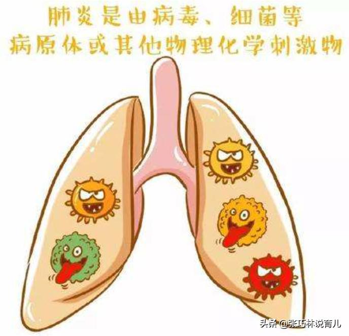 孩子得了肺炎一定要输液吗？医生：请避开这9个认知误区
