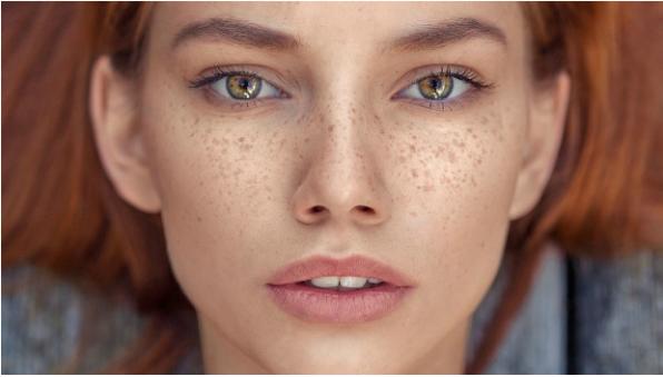 专家快速祛斑妙招推荐视频,皮肤科医生美白祛斑妙招