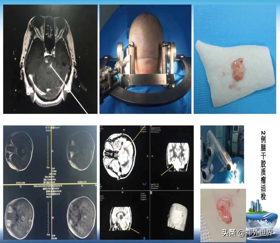 宣武医院神经外科王亚明祖籍,北京宣武医院神经科专家王亚明