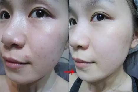 泫雅宣传品牌内衣,泫雅内衣广告曝光图片