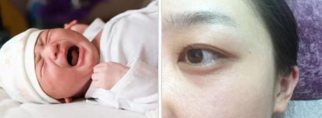 大人脸过敏刺痛能擦宝宝霜吗,大人可以抹小孩的宝宝霜吗