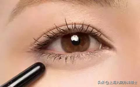 刚做完双眼皮闭眼总翻白眼正常吗,割了双眼皮为啥眼睛老流泪