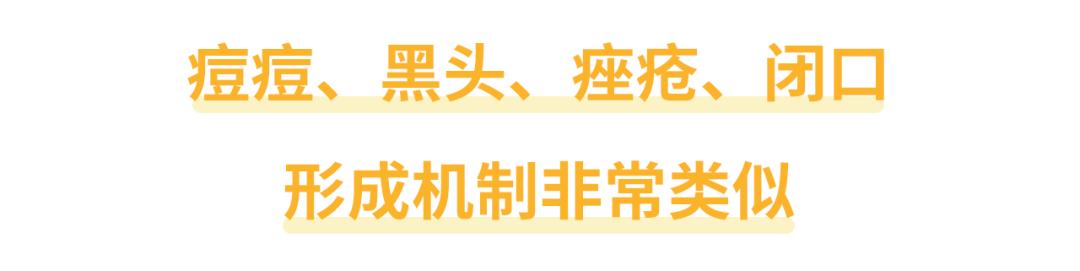 绝对不能挤的痘痘一般长什么样,哪里的痘痘不能挤