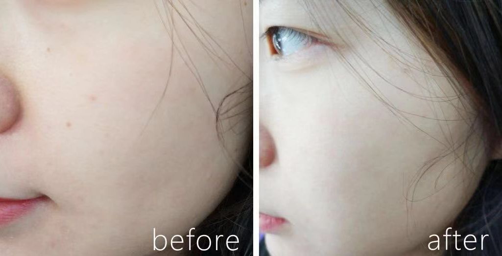 30多岁的她变瘦皮肤松弛,37岁女人瘦下来后变老了