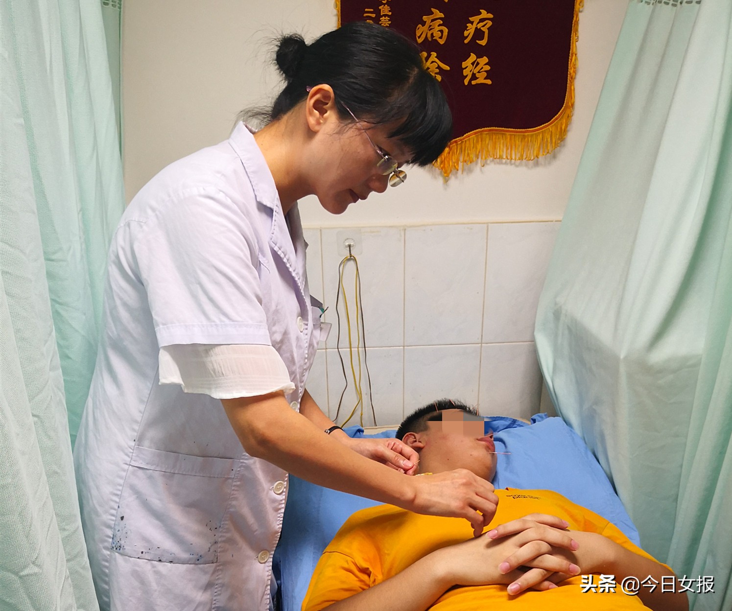 长沙少年熬夜通宵，结果嘴角歪了面瘫！在脸上扎根治疗，你敢试吗