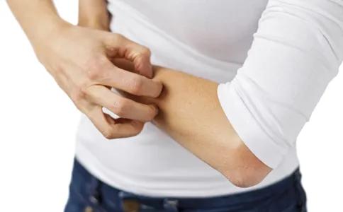 湿疹性皮炎最简单的自愈方法,全身都痒皮炎湿疹最好的治疗方法